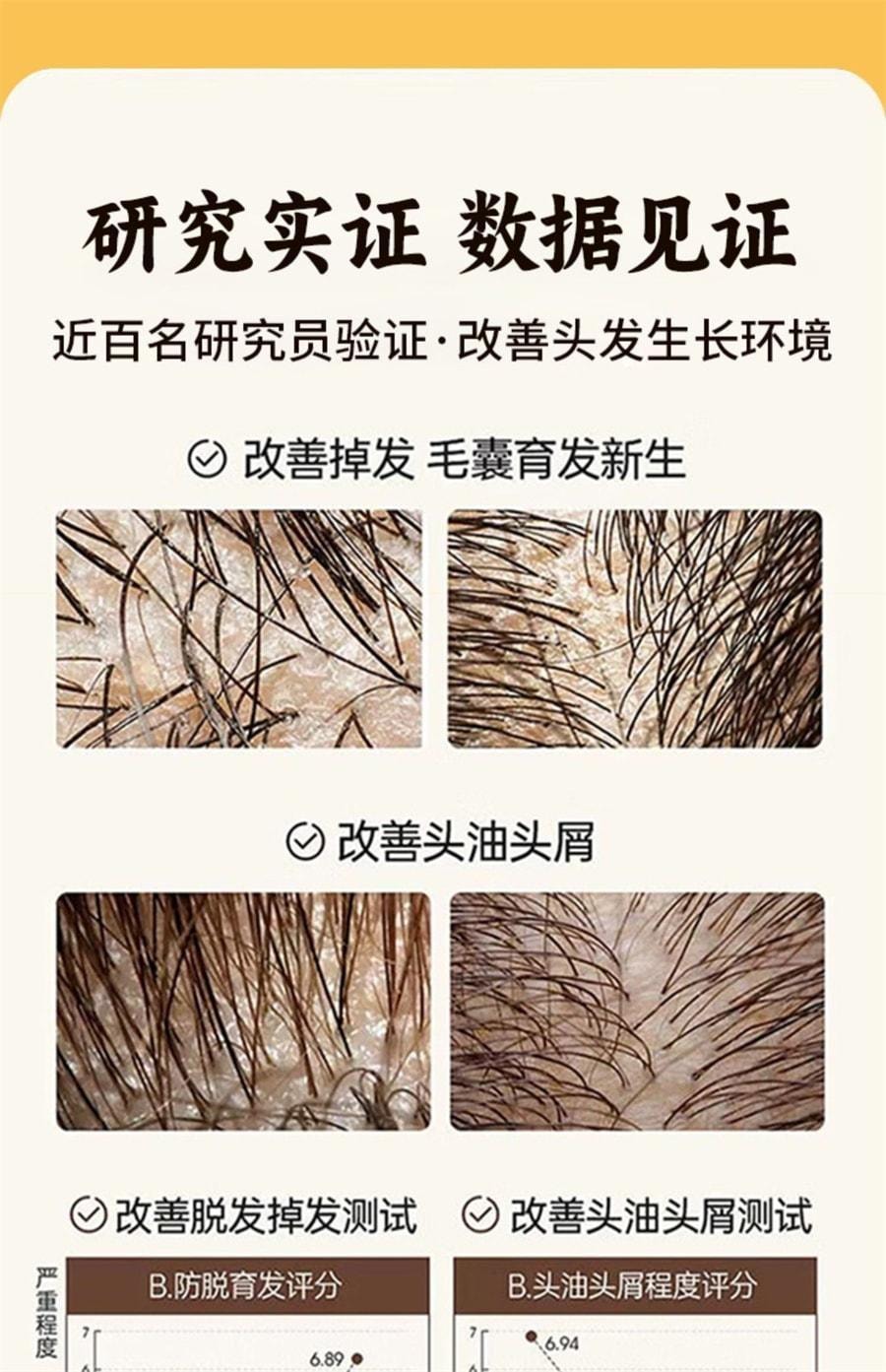 【中国直邮】 步长 荣发胶囊 改善掉发毛囊育发生发增发 防油脂溢性脱发斑秃补肝肾养气血 30粒/盒