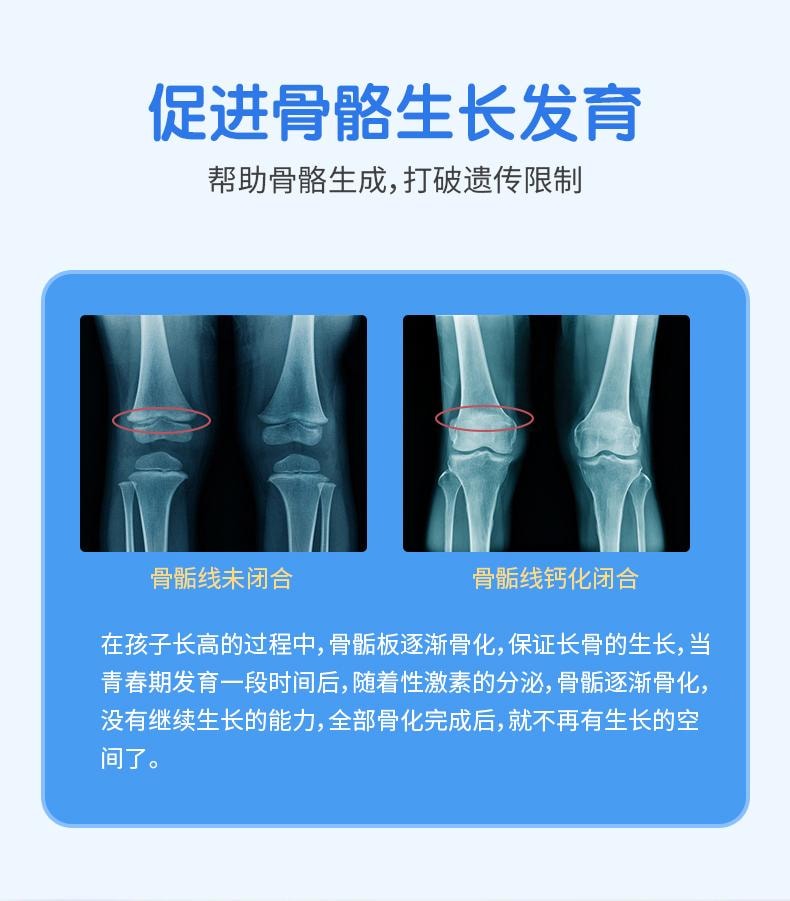 【中國直郵】 三精 賴氨酸磷酸氫鈣顆粒 補鈣助長高青少年兒童鋅賴氨酸 5g*40袋/盒