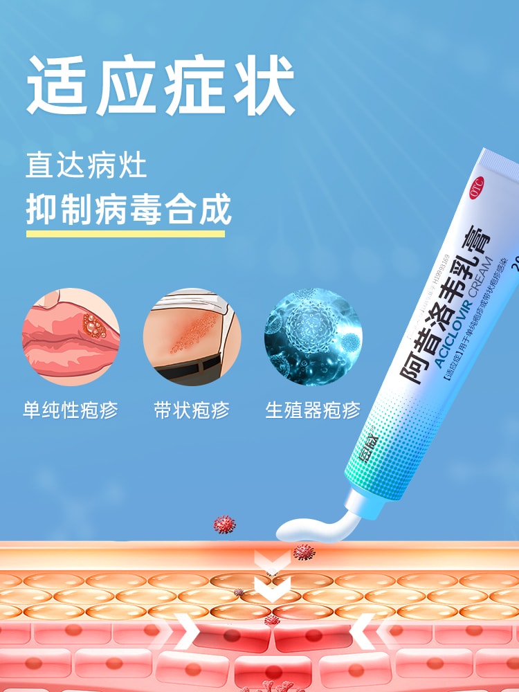 【中国直邮】 恩威 阿昔洛韦软膏 正品抗病毒阿西洛韦阿希洛韦带状单纯疱疹药膏 20g/盒
