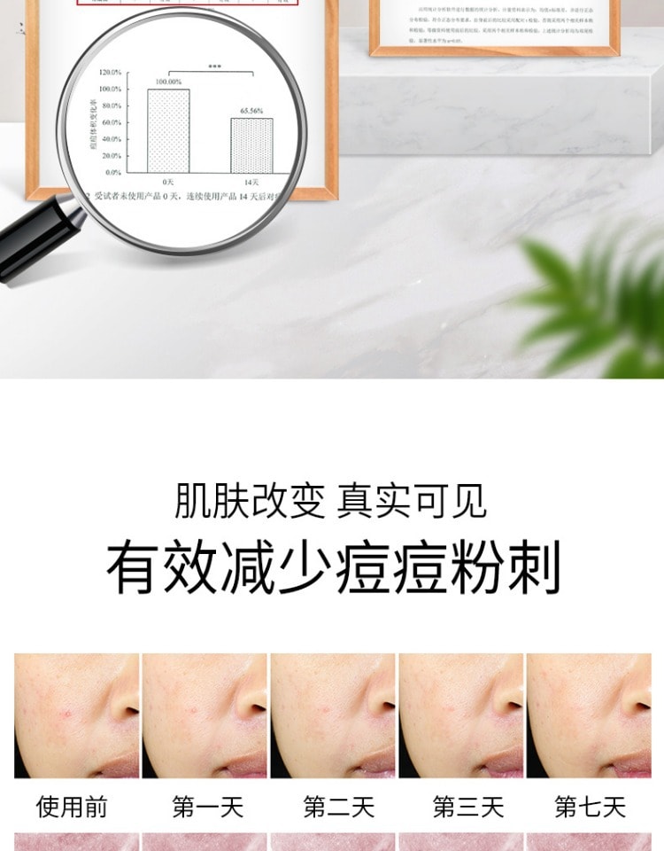 【中国直邮】美研因式 复合酸祛痘凝胶 控油清痘淡化痘印 舒缓修护细致毛孔 15g/支 (七老板推荐)
