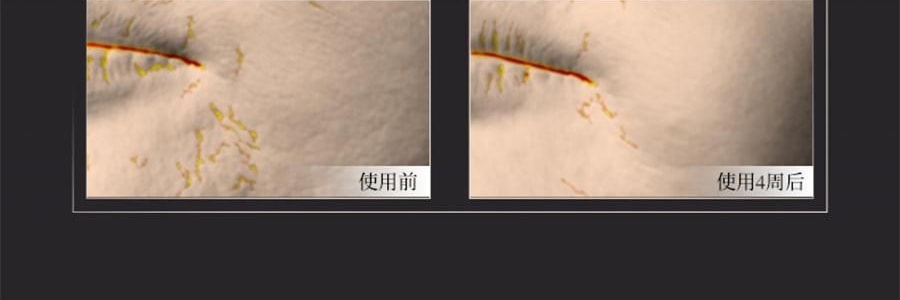 林清軒油膜套組*1組