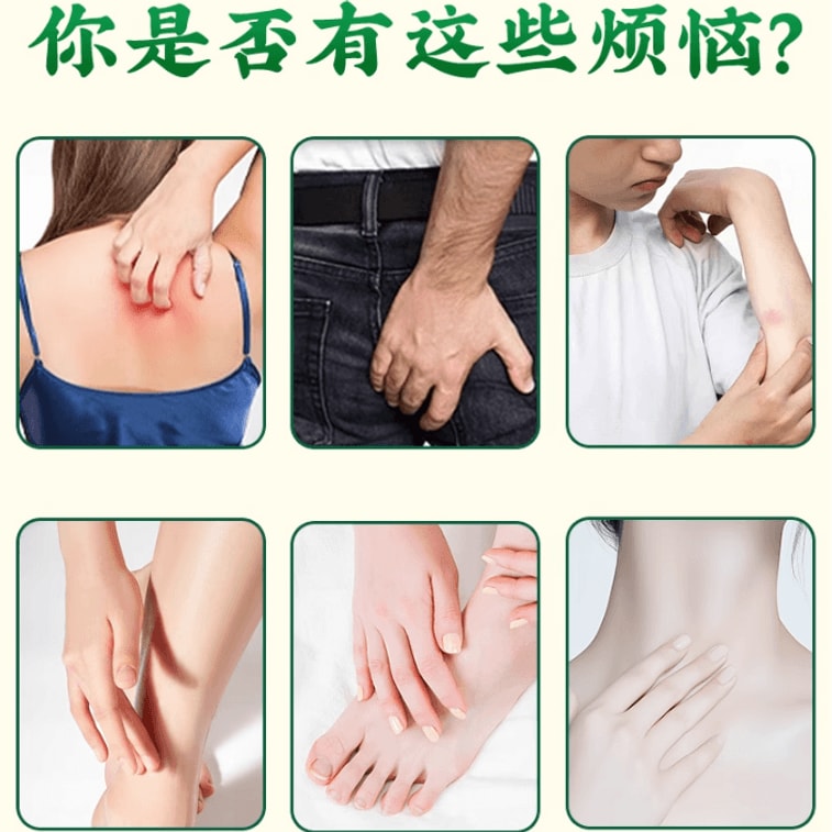 Fungus King 50g per box  for external use Antibacterial and anti-itch ointment