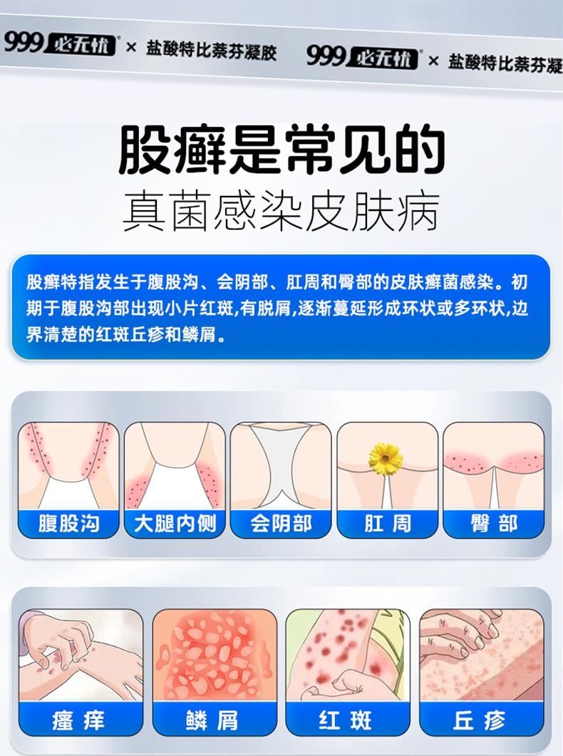 【中国直邮】 999 盐酸特比萘芬凝胶20g正品凝胶股藓廯癣专用药大腿内侧皮肤瘙痒止痒