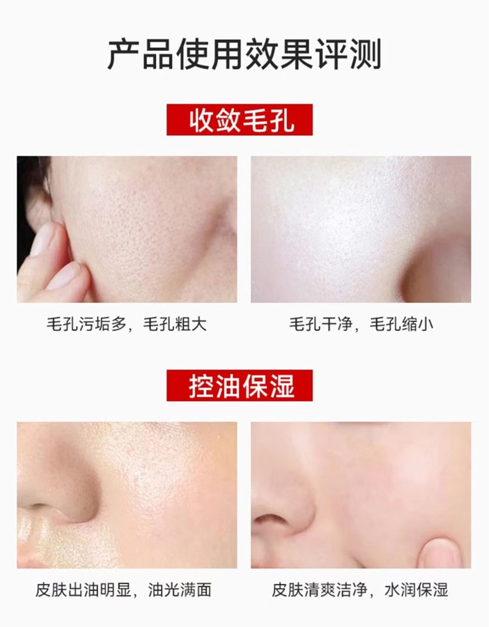 【中國直郵】Renhe 仁和匠心淨透毛孔收縮精華液100ml 1瓶裝 毛孔粗大補水保濕精華液收斂縮小 國貨之光