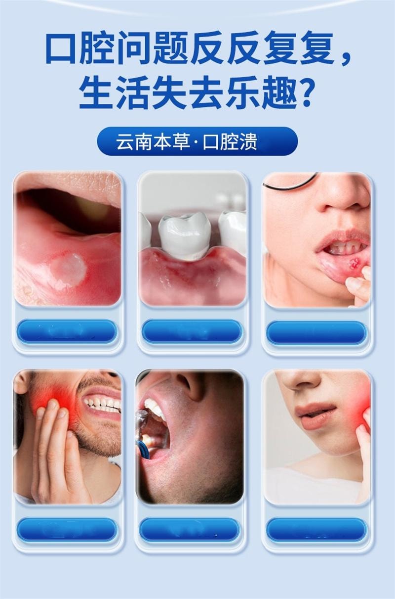 【中国直邮】 云南本草 口腔溃肠喷剂男女可用口腔护理 20ml/盒