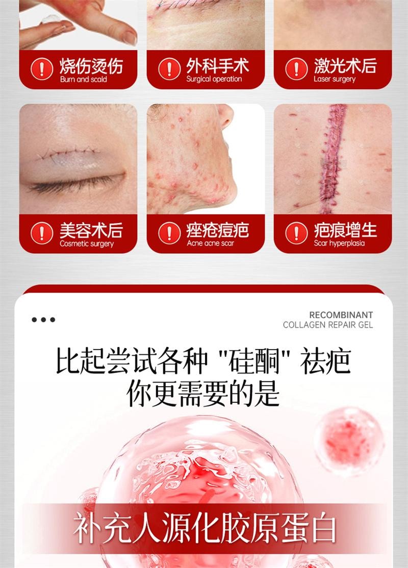 【中國直郵】 協和京品 祛疤膏疤痕修復除疤剖腹產手術疤兒童燙傷增生凸起去疤貼醫用重組膠原蛋白修復凝膠 20g