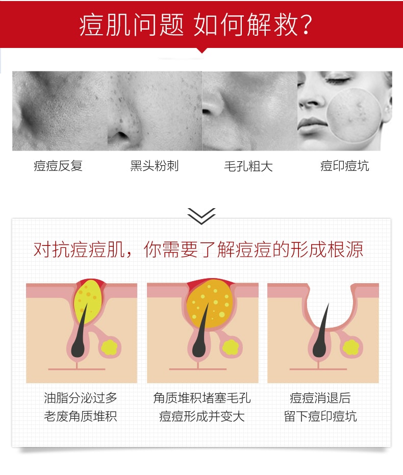 [中国直邮]薇诺娜(WINONA)复合水杨酸焕颜精华液  30ml 1支装