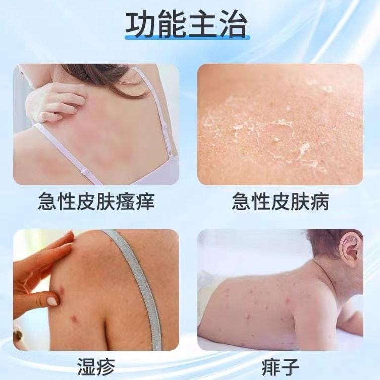 【中国直邮】 瑞林 炉甘石洗剂湿疹瘙痒皮炎痱子荨麻疹瘙痒性皮肤病止痒 100ml/瓶