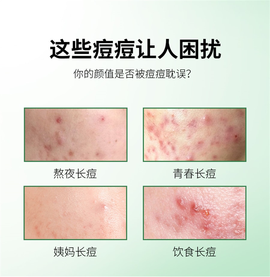 【中国直邮】仁和匠心 药业正品青春痘祛痘膏淡化痘印凝胶去痘闭口芦荟胶男女非 22g