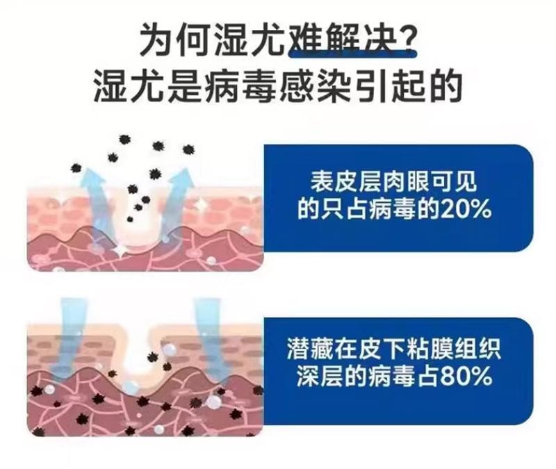 祥医堂 鬼臼毒素酊10ml/盒 去鸡眼尖锐丝状扁平克疣抑菌外用