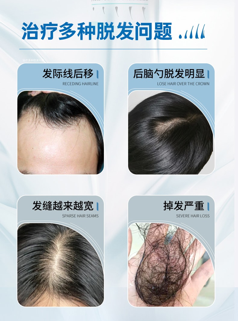 【中國直郵】洛芙 5%生髮液米諾地爾酊防脫育髮液增發米諾地爾酊頭皮上藥 50ml/瓶
