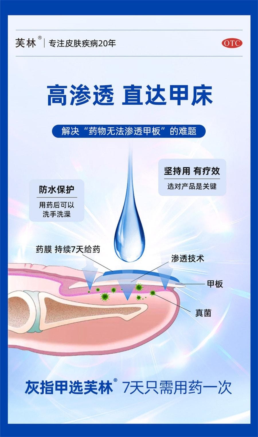 【中國直郵】 芙林 鹽酸阿莫羅芬搽劑 阿莫羅芬擦劑治灰指甲 強滲透 殺菌抑菌 1ml/盒