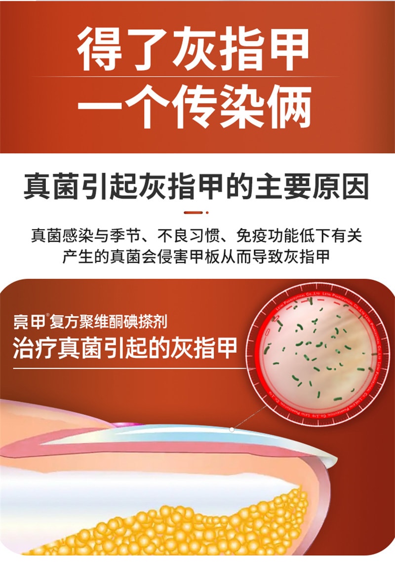 【中國直郵】亮甲 複方聚維酮碘搽劑灰指甲專用藥去甲癬治療指甲藥殺滅真菌 3mL x 1盒