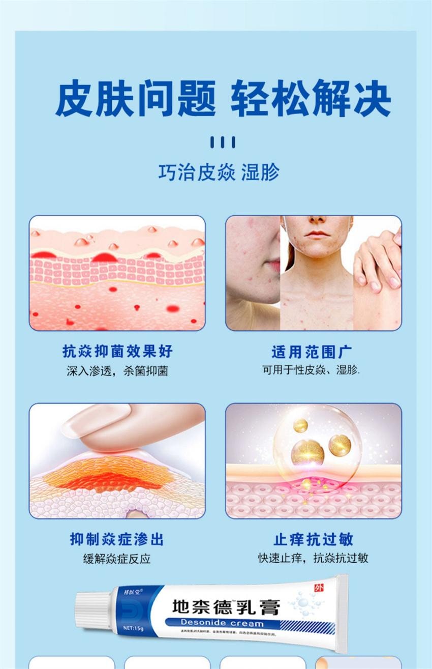 【中国直邮】 祥医堂 地奈德乳膏 适用于神经性皮炎 湿疹 皮肤瘙痒药膏 15g/盒(医师推荐拍3盒)