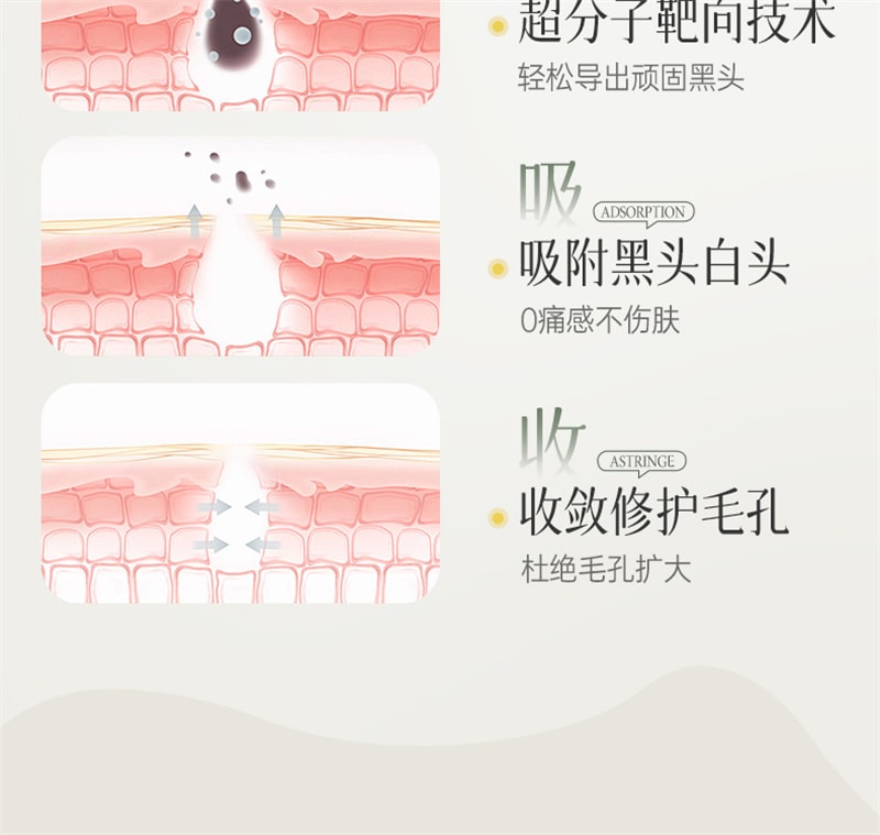 【中国直邮】 儒意 多酸净颜清肤泥膜 去黑白头闭口粉刺收缩深层清洁毛孔涂抹式积雪草清洁面膜 150g/瓶