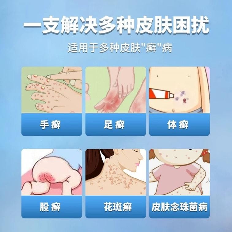 仁和 【连续28天彻底杀灭真菌】盐酸特比萘芬乳膏 10g 脚癣去脚气真菌感染专用 (医师推荐拍2盒)止痒脱皮杀菌手足癣症真菌感染水泡