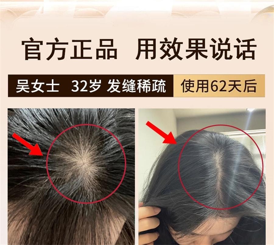 【中国直邮】 青幽堂 洗发水润养苗坚防脱洗发水丰盈固发养发育发苗坚防脱育发洗发水 400ml/瓶
