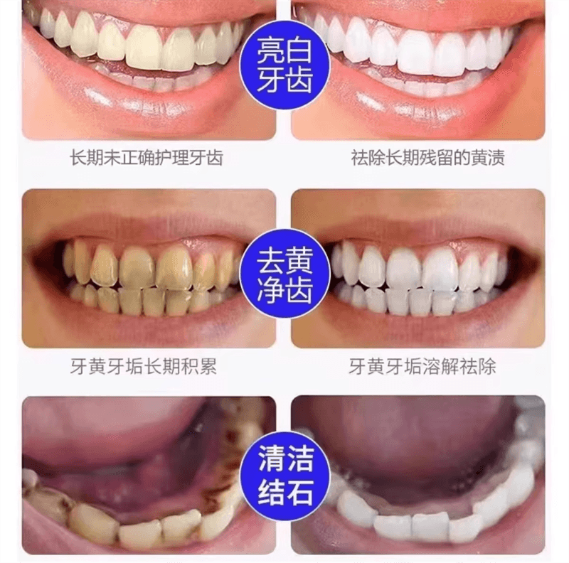 【中国直邮】仁和匠心 酵素牙膏美去白黄口臭成人洗白神器官方正品女男士专用 100g