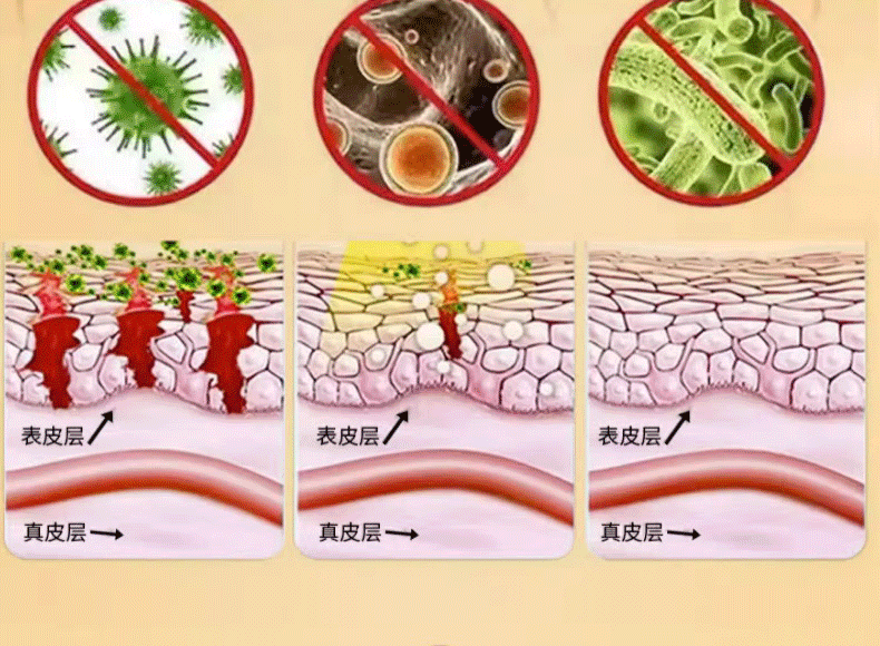 【中国直邮】 祥医堂 断痒王 止痒膏皮肤痒断痒膏 一抹止痒 草本秘制 安全健康 30g/盒