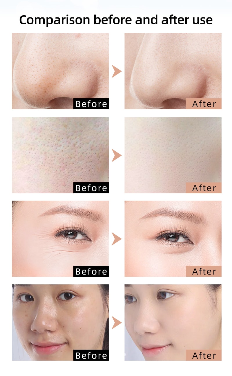 中國KAKUSAN卡酷尚新款矽膠美容面罩光子嫩膚儀光譜儀祛痘嫩膚美容儀 黑色 1件