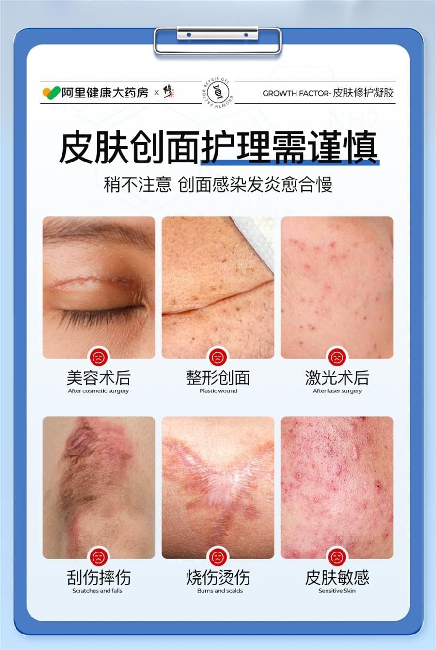 限定価格セール！ 中国からの直送] Xiuzhen 組み換えヒト上皮成長 医療グレード 健康・医学