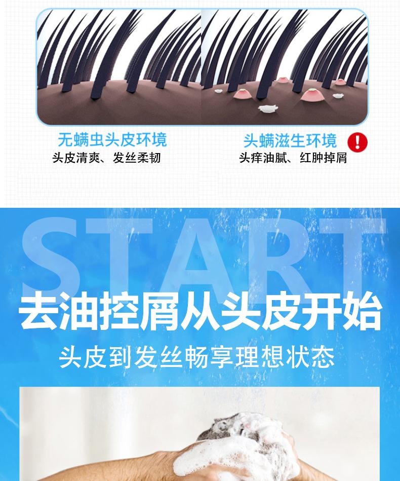  祥医堂 煤焦油抑菌洗液 抗皮脂溢出 改善止痒头皮控油去屑神器洗发水 60ml/盒