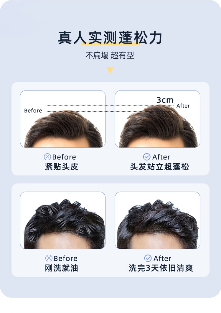 【中国直邮】蔓迪   男士活力洗发水拒绝头发坍塌油   150g男士
