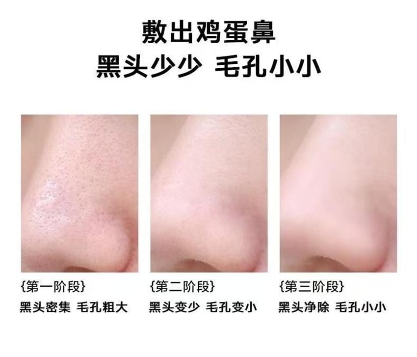 【中國直郵】 BYTREE'S 柏翠絲 淨護黑頭導出鼻膜套盒 黑頭收割機 收縮毛孔深層清潔黑頭粉刺 6對/盒【送黑頭鏟】