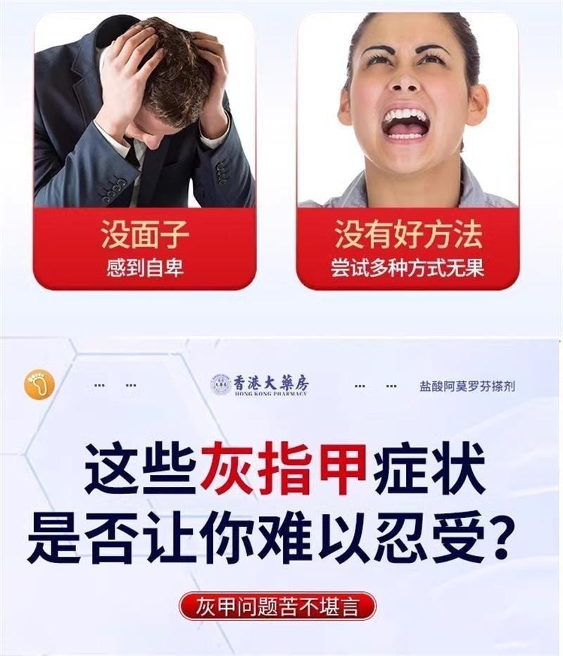 【中國直郵】 香港大藥房 鹽酸阿莫羅芬搽劑 灰指甲專用藥腳氣甲癬甲真菌病 30ml/盒(養成好甲)