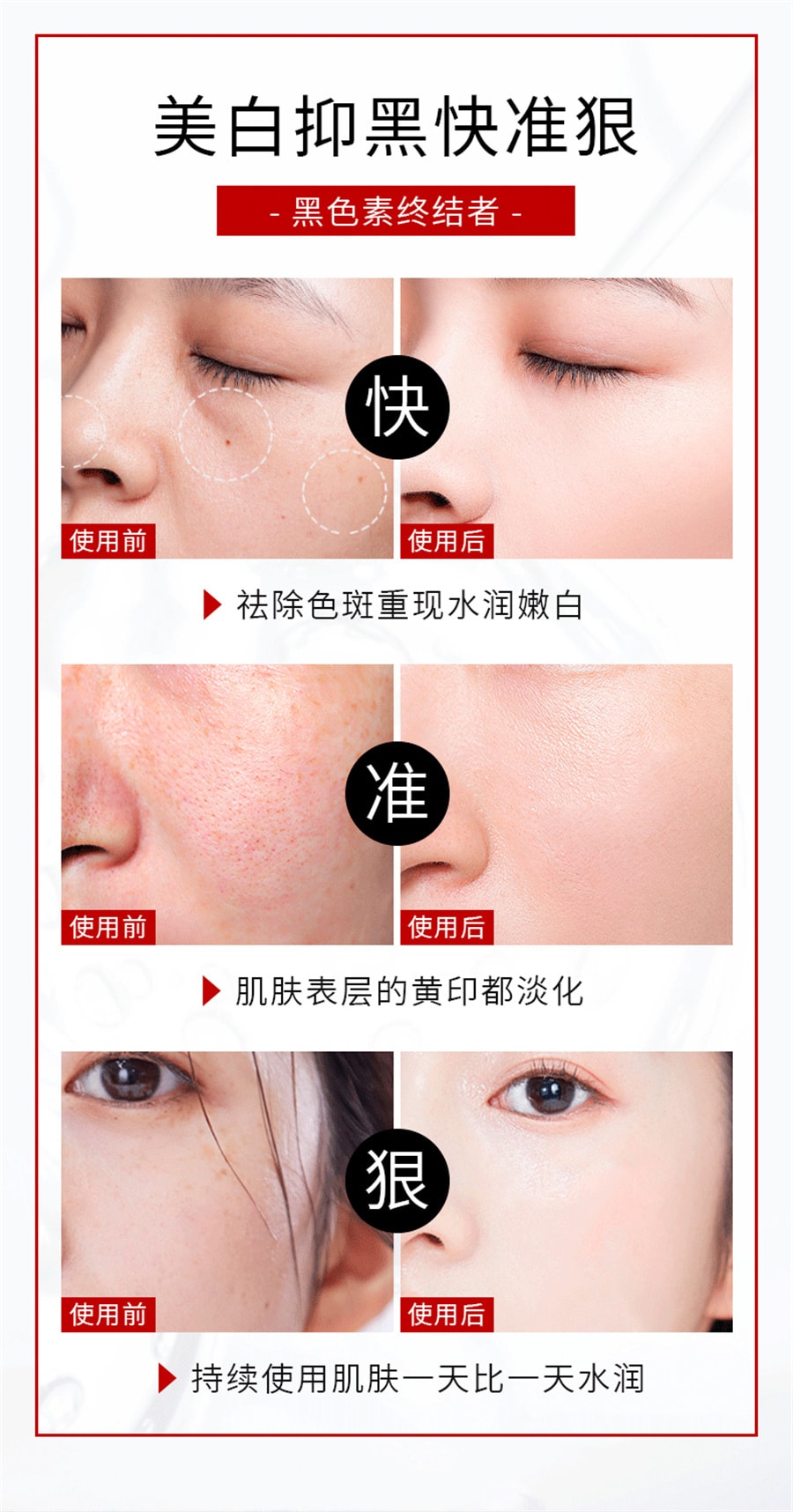 【中国直邮】有美博士 美白洗面奶烟酰胺补水保湿控油清洁泡沫美白洁面乳 200g