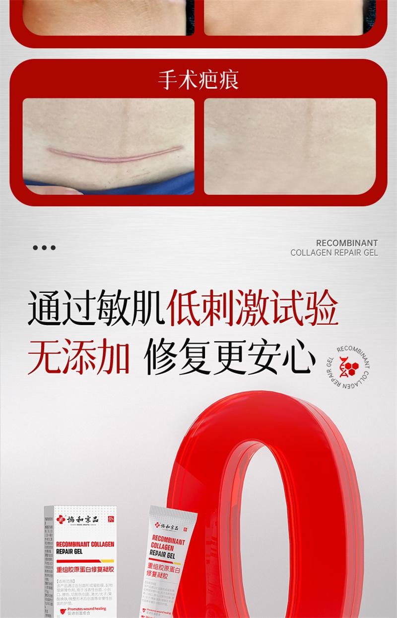 【中國直郵】 協和京品 祛疤膏疤痕修復除疤剖腹產手術疤兒童燙傷增生凸起去疤貼醫用重組膠原蛋白修復凝膠 20g
