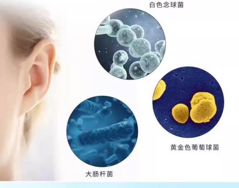  祥医堂 耳痒耳鸣滴耳水耳痛耳朵起皮护理液 氟康唑滴耳液10ml