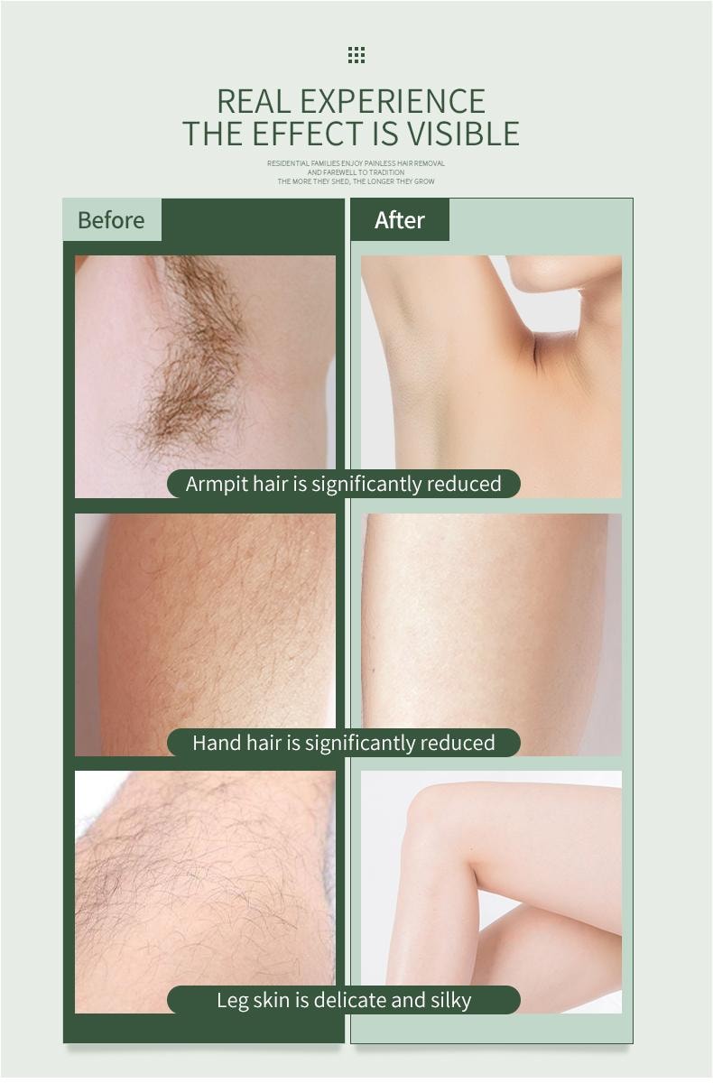 金稻 電動除毛儀 私密處毛修剪器 女士剃毛器 刮毛腋毛 全身可用 家用 KD50 綠色 1台