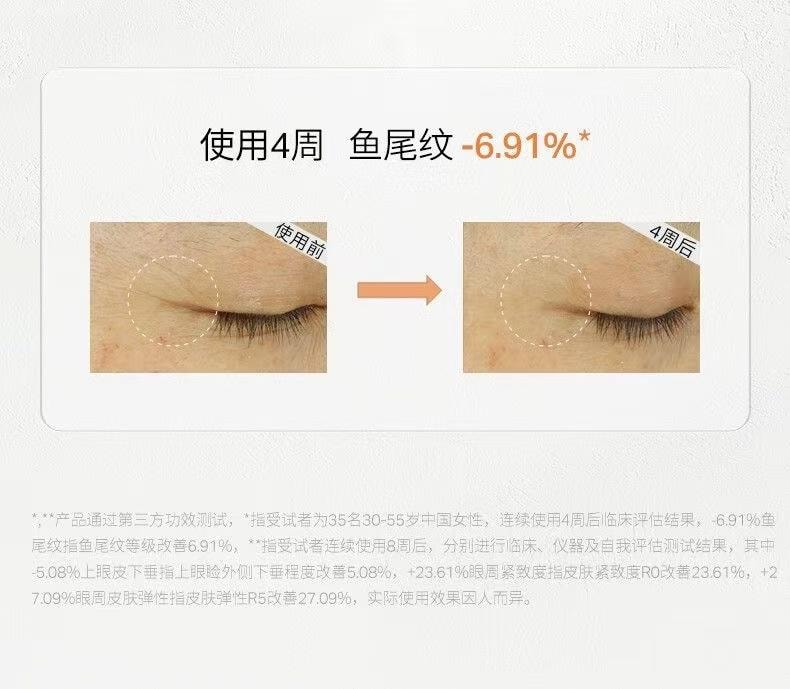 【中國直郵】 優時顏 微笑眼霜 淡紋緊緻眼部精華霜 抗皺淡黑眼圈 熬夜鬆垮救星 18g