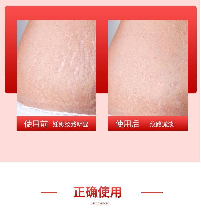 【中國直郵】健醫師 疤痕修復凝膠 淡化疤痕燒傷燙傷疤術後疤痕修復疤痕膏 20g/支
