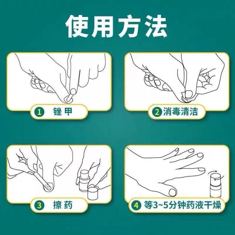 【中国直邮】  祥医堂 阿莫灰甲抑菌擦剂 修复灰指甲脱甲液 阿莫罗芬搽剂灰指甲正品 5ml/盒