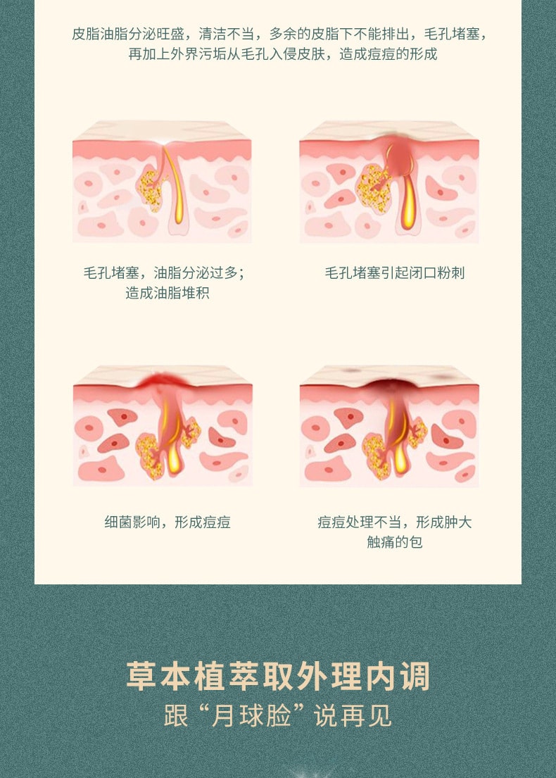 【中国直邮】白云山 净颜修护淡化青春痘去痘膏 30g