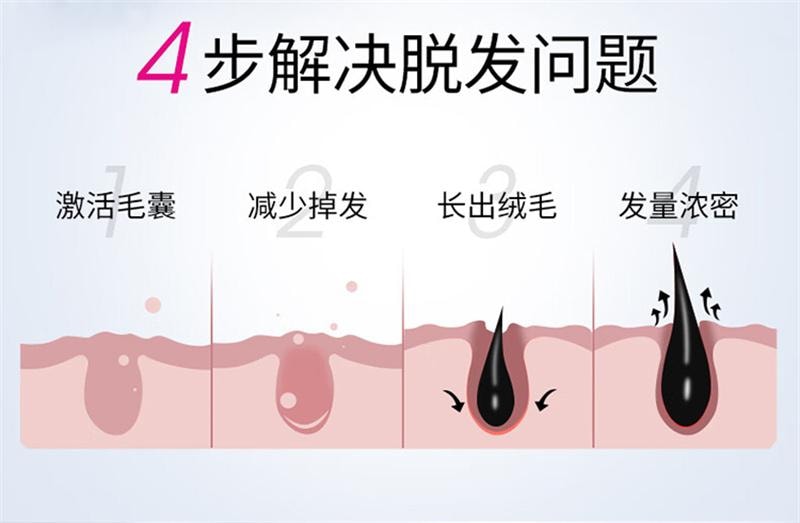 【中國直郵】 仁和 米諾地爾搽劑生髮液女性專用非酊脫髮增發 120ml
