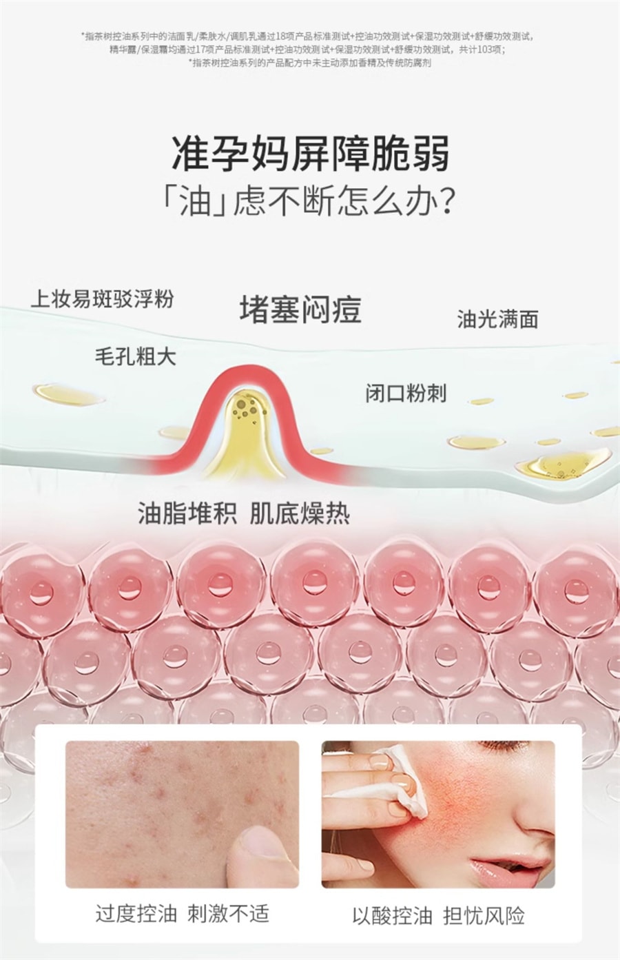 【中国直邮】袋鼠妈妈  准孕妇护肤品茶树控油套装补水保湿水乳油皮专用化妆品  茶树柔肤水150ml+茶树调肌乳120g