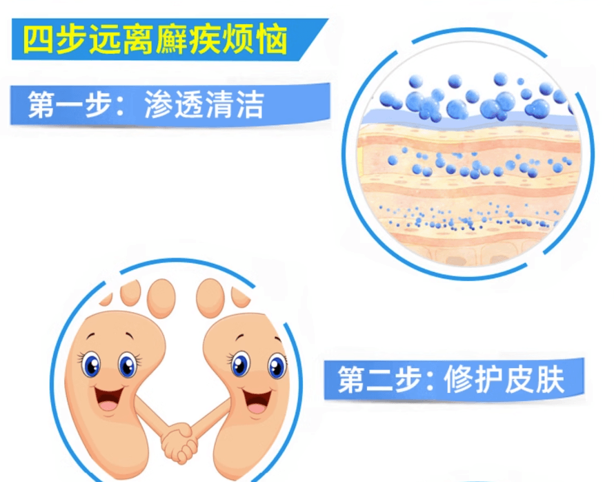 【日本直邮】乐敦全脚用脚气治疗软膏杀菌止痒去角质乳霜35克