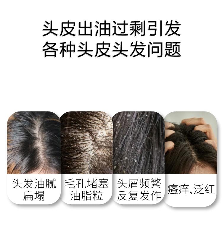 【中国直邮】 John Jeff 二硫化硒洗发水300g 去屑舒痒 告别油扁塌 三效合一