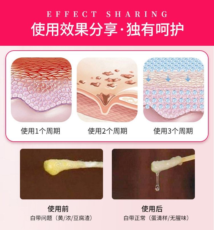 中國直郵 OEM 草本婦科凝膠私人護理凝膠女性私人護理抑菌婦科凝膠 3g/支x6支裝