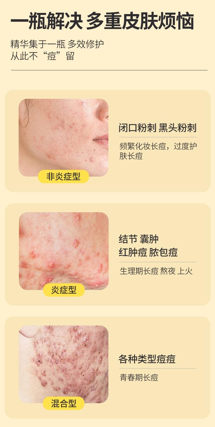 Seven-Flavor Turmeric Liniment 10ml per box