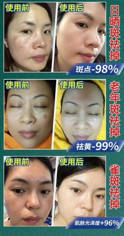 【中国直邮】 北京同仁堂 德德维芙焕颜美白精华液 美白祛斑 亮肤淡印 50ml