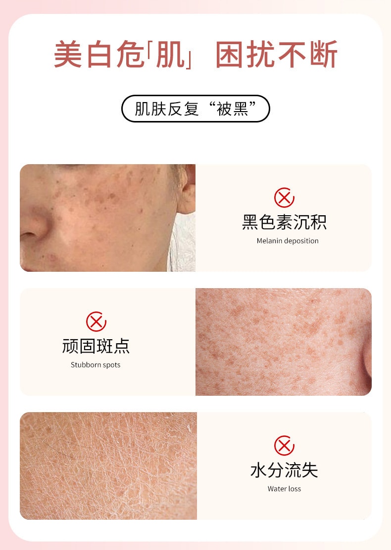 【中國直郵】 翼顏 熊果苷乳膏 補水保濕淡化色斑黃褐斑提亮膚色滋潤修復面霜 30g/支