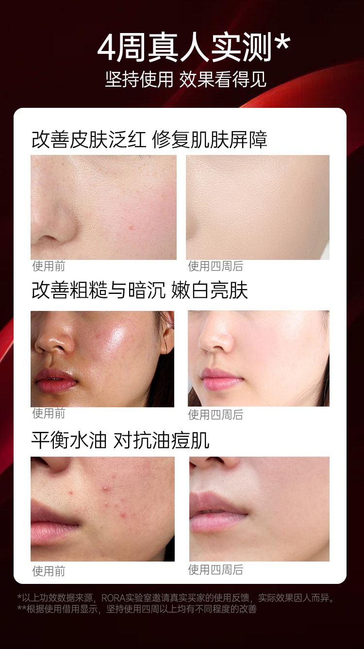 中國RORA 光子嫩膚面膜儀紅藍光美容儀 黑色 1件