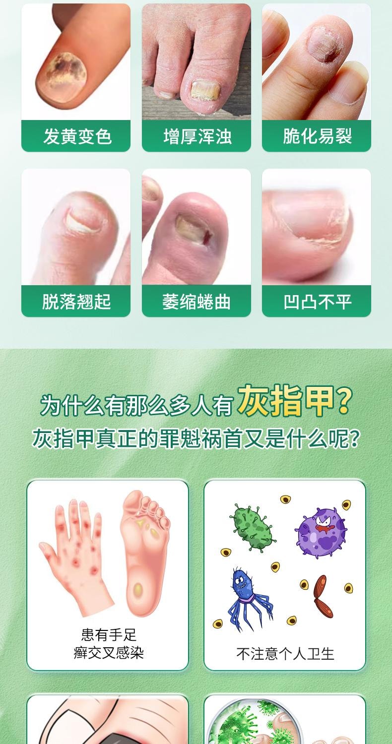 【中國直郵】 修正 環吡酮胺乳膏 治腳氣止癢脫皮殺菌專用藥膏真菌感染水泡灰指甲 15g/支(醫師推薦拍3盒)