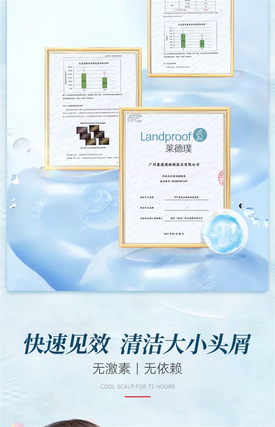 【中国直邮】999  二硫化硒洗发水去屑控油蓬松脂溢性皮炎毛囊清洁洗发乳止痒  200ml/瓶