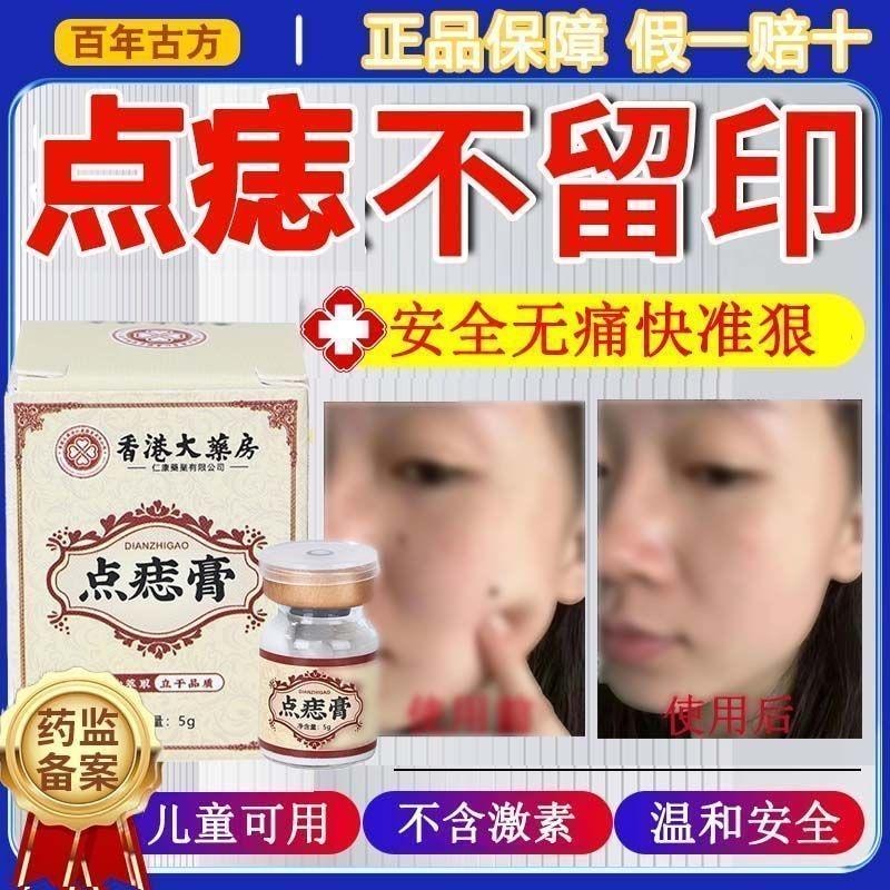 Hong Kong Pharmacy Spot Removal Cream Scarless Spot and Mole Removal Water for Face 5g/Box