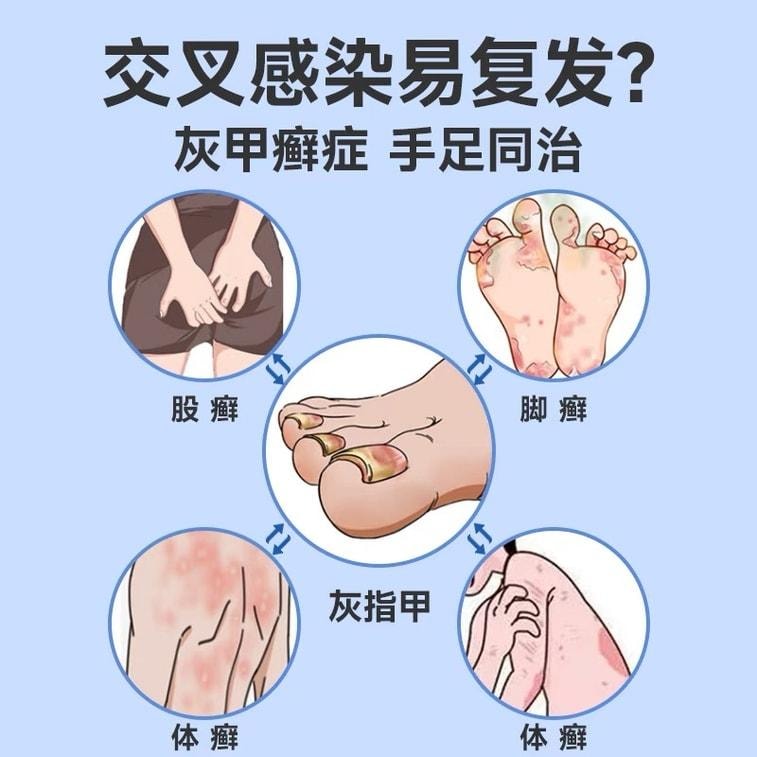 【中國直郵】 恆醫森 環吡酮胺乳膏 20g/支